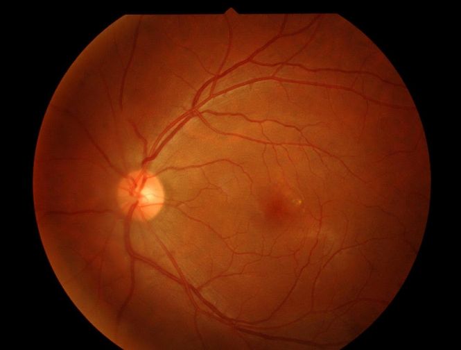 The advanced eye examination with OCT (Optical Coherence Tomography)